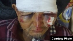Тошкент яқинида калтаклаб кетилган журналист Бахтиёр Эсонов