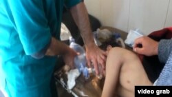 Врачи оказывают помощь сирийскому ребенку, пострадавшему при химической атаке.