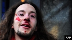 A gay rights activist stands in front of the State Duma after being punched during a protest in Moscow on January 22.