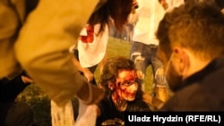 Една от ранените протестиращи жени по време на протестите в Минск
