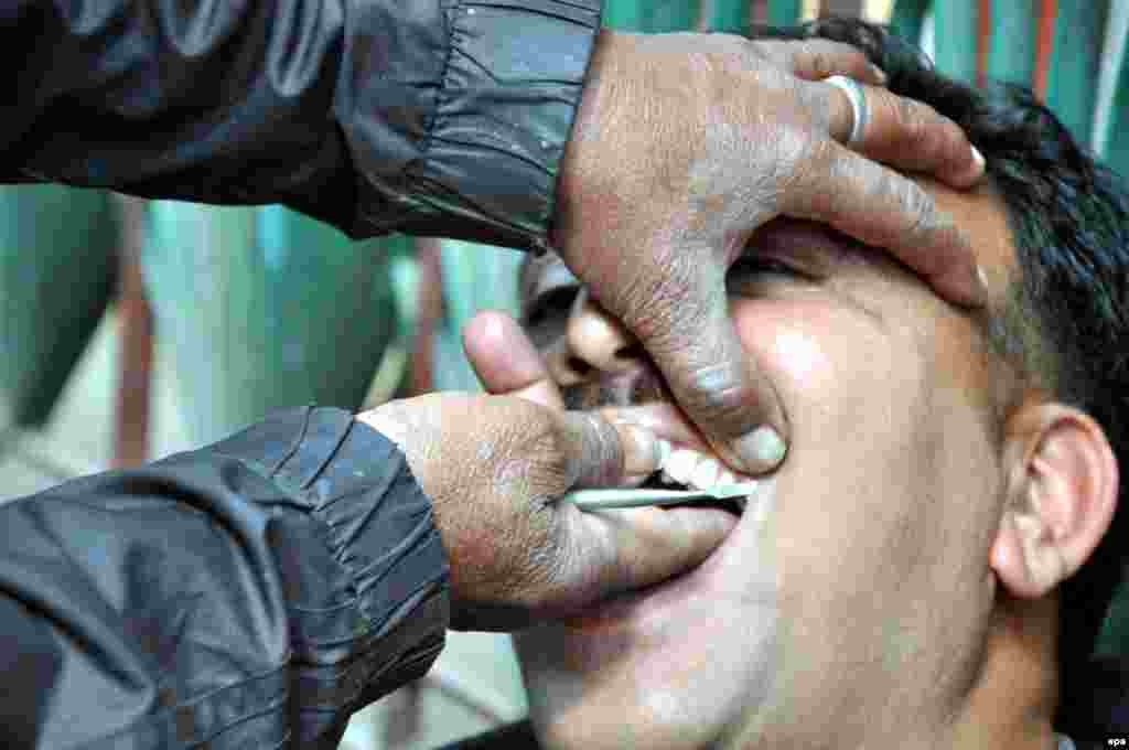 A self-styled roadside dentist treats a patient at McLeod Ganj near Dharamsala in India on February 21. (AFP/Sanjay Baid)