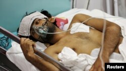  A wounded Afghan man who survived a U.S. air strike on a Medecins Sans Frontieres (MSF) hospital in Kunduz receives treatment at the Emergency Hospital in Kabul on October 8, 2015.