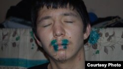One of the more than 1,000 prisoners across Kyrgyzstan's penitentiary system who sewed his lips together in protest.