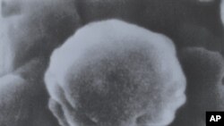 Увеличенное изображение вируса иммунодефицита