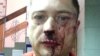 В Москве избили активиста, критиковавшего главу управы Сокольников