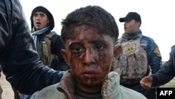 İraqın Havica şəhərində İŞİD-dən xilas edilmiş uşaq