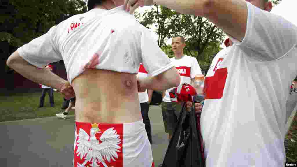 A Polish soccer fan shows a wound from a rubber bullet during clashes with police and Russian fans in Warsaw.