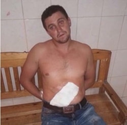 Один з нападників на Сергія Стерненка Олександр Ісайкул отримав державну охорону як «ключовий свідок»