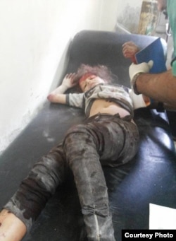 Девочка, раненая при авиаударе российских войск по городу Джиср-Эш-Шур. Фото предоставлено Радио Свобода активистами оппозиционной сирийской коалиции "Армия завоевания"