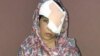 Salema Akhundzada endured 11 hours on poor roads before she and her mother arrived at Kabul's Emergency Hospital for treatment. The doctors there were unable to save her left eye.