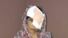 Salema Akhundzada endured 11 hours on poor roads before she and her mother arrived at Kabul's Emergency Hospital for treatment. The doctors there were unable to save her left eye.