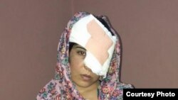 Salema Akhundzada endured 11 hours on poor roads before she and her mother arrived at Kabul's Emergency Hospital for treatment. The doctors there were unable to save her left eye.