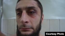 Азамат Казанчев, избитый в Зеленоградском районном суде Москвы