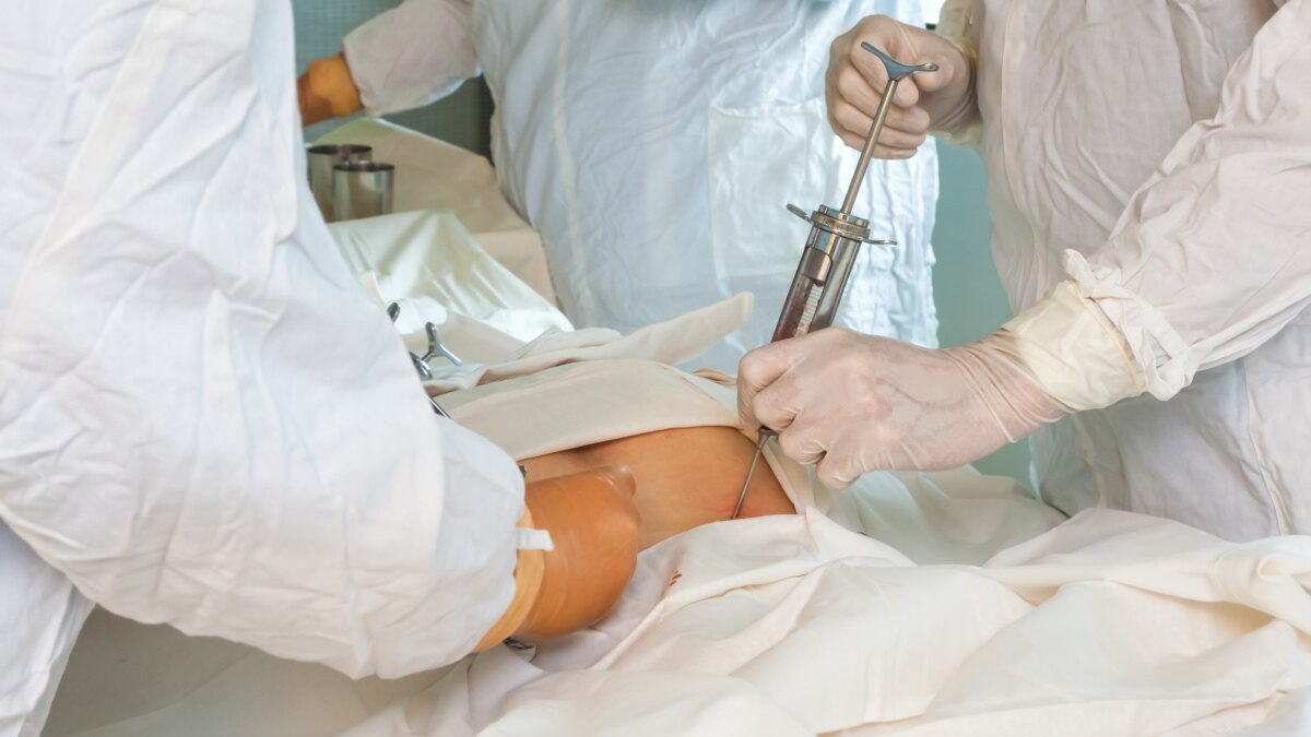 В Україні вперше здійснили трансплантацію кісткового мозку дорослому від неродинного донора – Ляшко