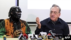 Indian activist Sudheendra Kulkarni (L), whose face was blackened by ink in an alleged attack, looks on as former Pakistani foreign minister Khurshid Mahmud Kasuri speaks to media in Mumbai on October 12.