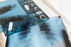 Көрнекі сурет.