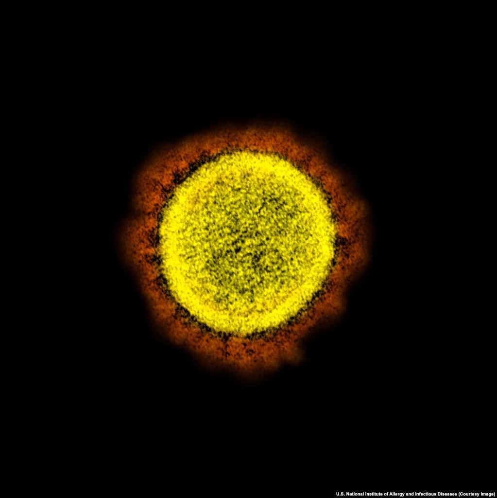 Віріон SARS-CoV-2. Під мікроскопом навколо вірусу видно відростки, що нагадують сонячну корону, тому в його назві присутнє слово «корона»