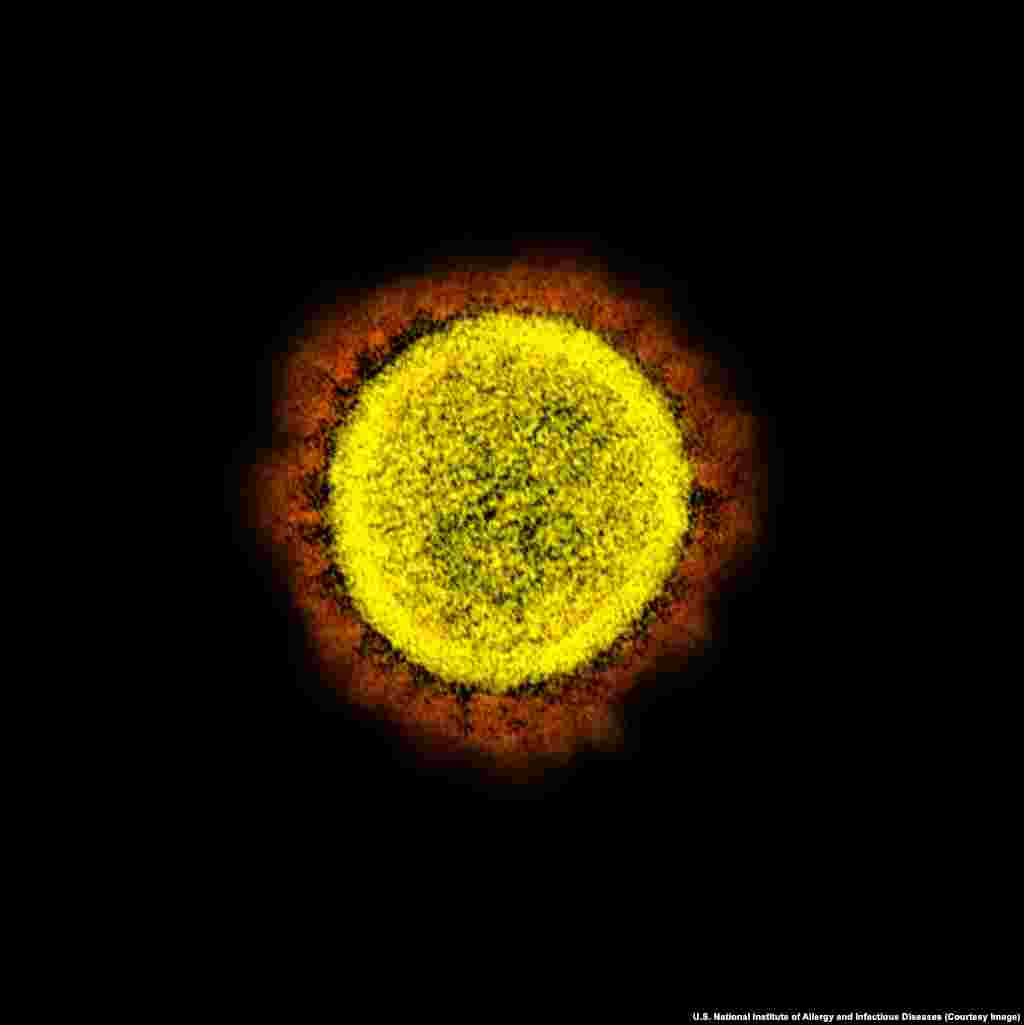 Віріон SARS-CoV-2. Під мікроскопом навколо вірусу видно відростки, що нагадують сонячну корону, тому в його назві присутнє слово &laquo;корона&raquo;