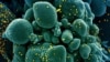 Imagine reprezentând SARS-COV-2 (în galben), care a infectat un țesut (în verde), realizată de cercetători americani