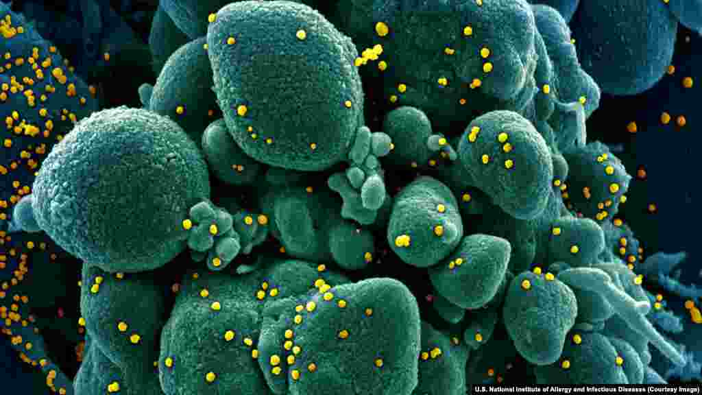 Вирионы SARS-CoV-2 на поверхности человеческой клетки. Коронавирусы &ndash; семейство патогенов, в которое входят смертоносные вирусы SARS (вызывает атипичную пневмонию) и MERS (ближневосточный респираторный синдром), а также несколько других относительно безопасных разновидностей вируса