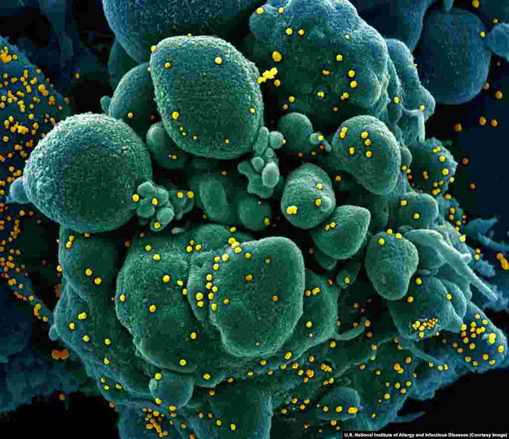 Вируси на САРС-КоВ-2 во човечка ќелија. Коронавирусите се семејство на патогени микроорганизми кои вклучуваат смртоносен САРС и МЕРС, како и неколку други релативно безопасни сорти на вирус.