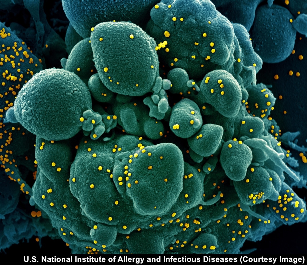 human cell under electron microscope