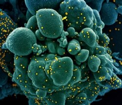 Коронавірус під мікроскопом: віріони SARS-CoV-2 на поверхні людської клітини