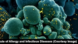 Imagine a unei celule (în verde) infestate cu noul coronavirus (în galben), realizată de cercetătorii americani