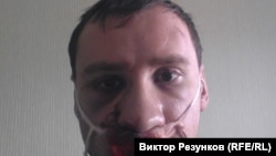 Егор Алексеев после избиения