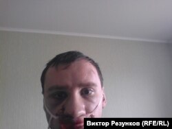Єгор Алєксєєв після побиття