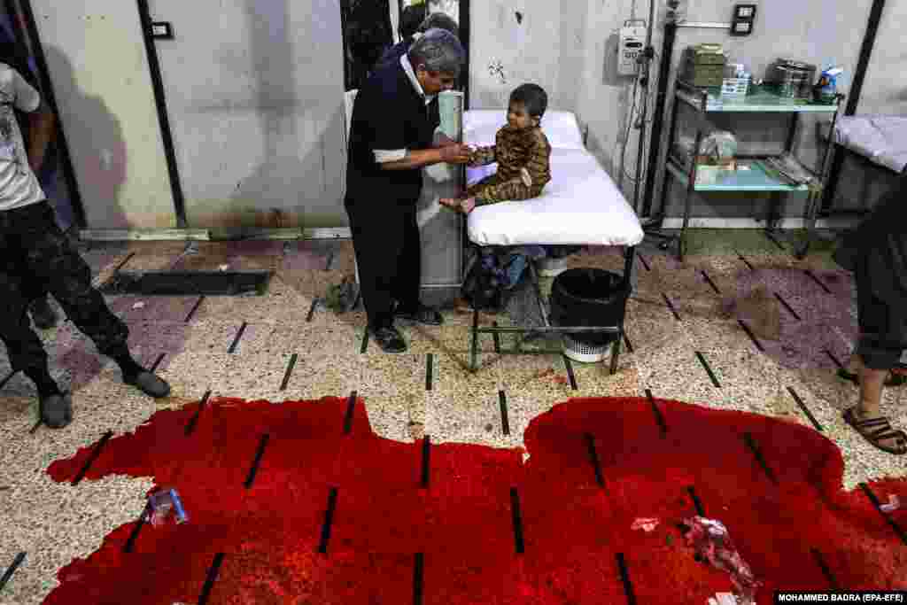 A hospital in Douma, Syria, October 26,&nbsp;2017. Seven people were killed after bombs were dropped on civilian areas, allegedly by forces loyal to the Syrian regime. (EPA-EFE/Mohammed Badra) &nbsp;