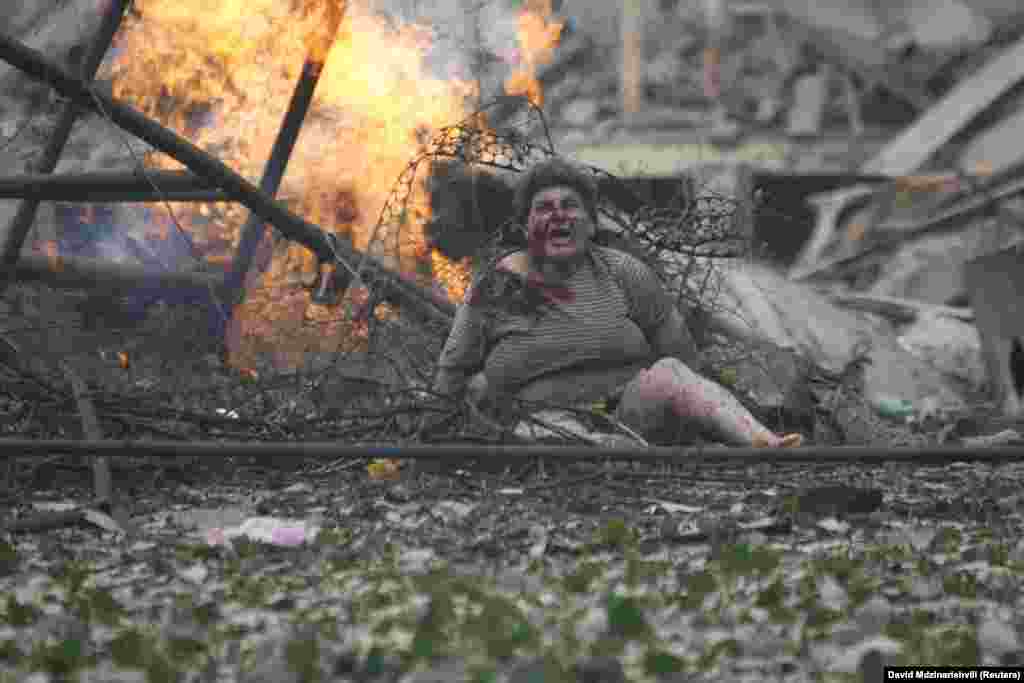 Тбилисиден 80 шақырым жердегі Гори қаласында соғыс барысында жараланған әйел. 9 тамыз 2008 жыл.