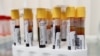 RUSSIA -- Vials with blood samples are pictured at a clinic providing testing for the coronavirus disease (COVID-19) and antibodies, after authorities launched free mass screening for residents in the Russian capital, in Moscow, May 15, 2020