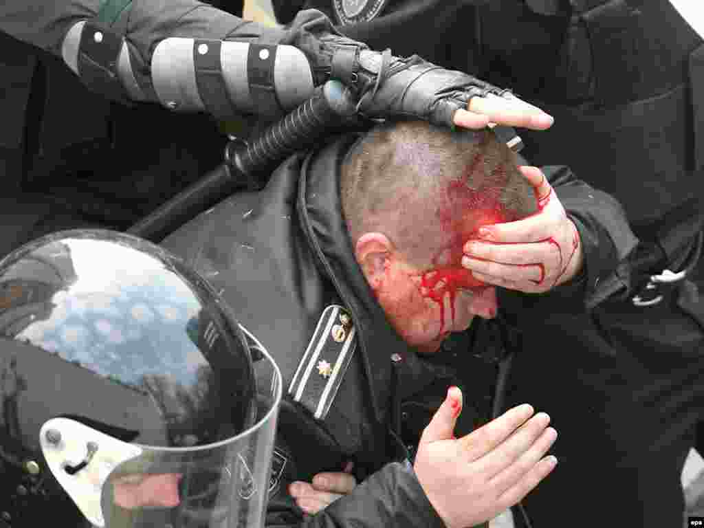 Caption: epa01690541 Police officers escort a policeman who was injured in anti-communist demonstrations in Chisinau, Moldova, 07 April 2009. Thousands of anti-communists protesters, most of them students, gathered to contest parliamentary elections results, asking for new elections. Although Moldova's ruling communist party gained enough votes to hold on to power in parliament on 05 April 2009, they lacked the number of seats to install a new president.