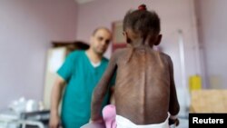 Një doktor në Jemen, trajton një fëmijë të kequshqyer. Foto nga arkivi. 