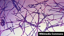 صورة مكبرة للبكتيريا المسببة لمرض الأنثراكس 