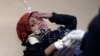 سازمان ملل:‌ یمن در معرض بزرگترین بحران امنیت غذایی جهان قرار دارد