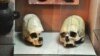 В Ингушетии нашли скелет древней женщины со странным черепом