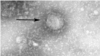 Un anticorp care poate combate coronavirusul? O descoperire a cercetătorilor belgieni