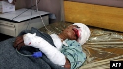 آرشیف/ یک پسر افغان که در اثر انفجار ماین زخم برداشته است