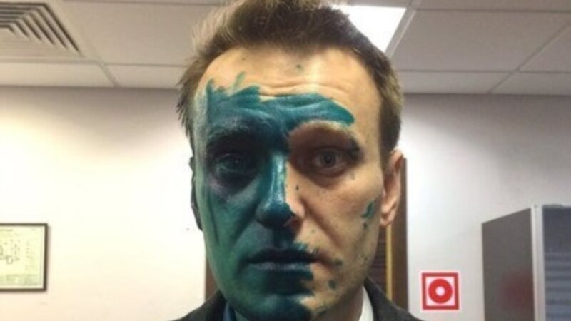 Навальный: полиция намеренно не расследует нападение 27 апреля