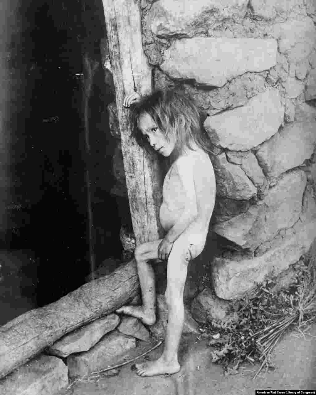 A starving 7-year-old child in Russia's Samara region in 1921. By the time the war neared its end, Russia's economy had collapsed, crops had failed due to a drought, and the Bolsheviks' "War Communism" that mandated the forcible seizure of grain from peasants left millions of Russians in a desperate situation.
