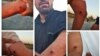 تصاویر منتشرشده از شلیک مأموران با گلوله‌های ساچمه‌ای به مردم روستای ابوالفضل اهواز