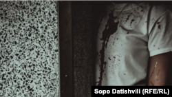 საილუსტრაციო ფოტო 