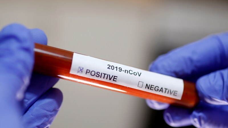 Ветеринарниот факултет прави 35 тестови за коронавирус дневно