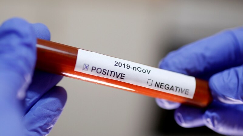 Кинески тестови за коронавирус препакувани како холандски завршиле и во земјава