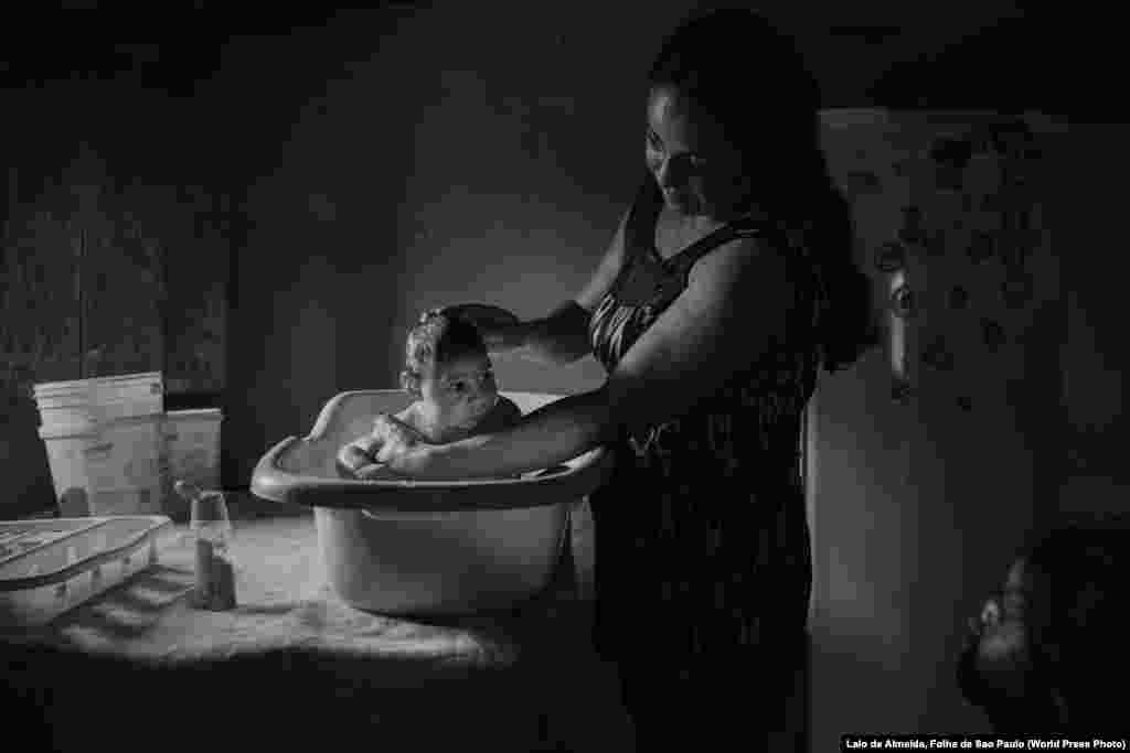 Adriana Cordeiro Soares bathes her son Joao Miguel, who was born with microcephaly caused by the Zika virus, in her house in the rural area of Sao Vicente do Serido, Brazil. Contemporary Issues -- Second Prize, Stories (Lalo de Almeida, for Folha de Sao Paulo)&nbsp;