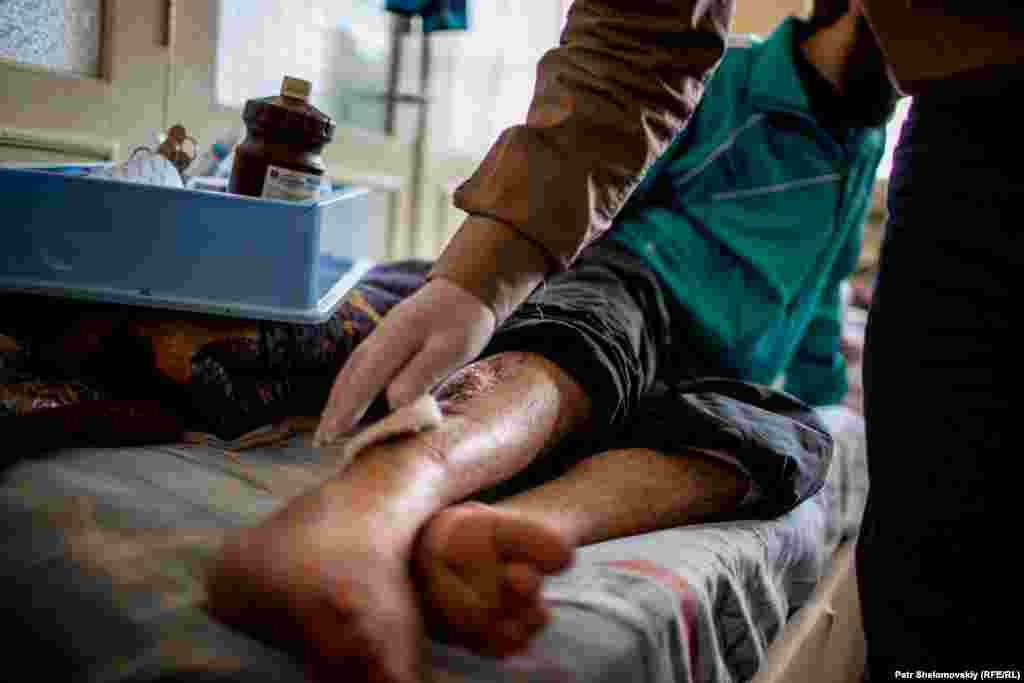 Abu Hamza, nga Aleppo, ndodhet në spital që tre muaj, që nga koha kur i mori lëndimet në këmbë. Djaloshi 21 vjeçar thotë se ishte viktimë e sulmeve ajrore të Rusisë. &nbsp;