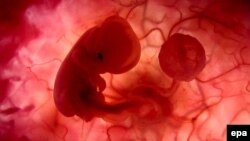 Fetus, ilustrativna fotografija