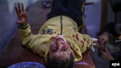 A Syrian child receives first aid in a field hospital following an air strike by forces loyal to the Syrian government in the rebel-held area of Douma, on the outskirts of Damascus, on November 10.